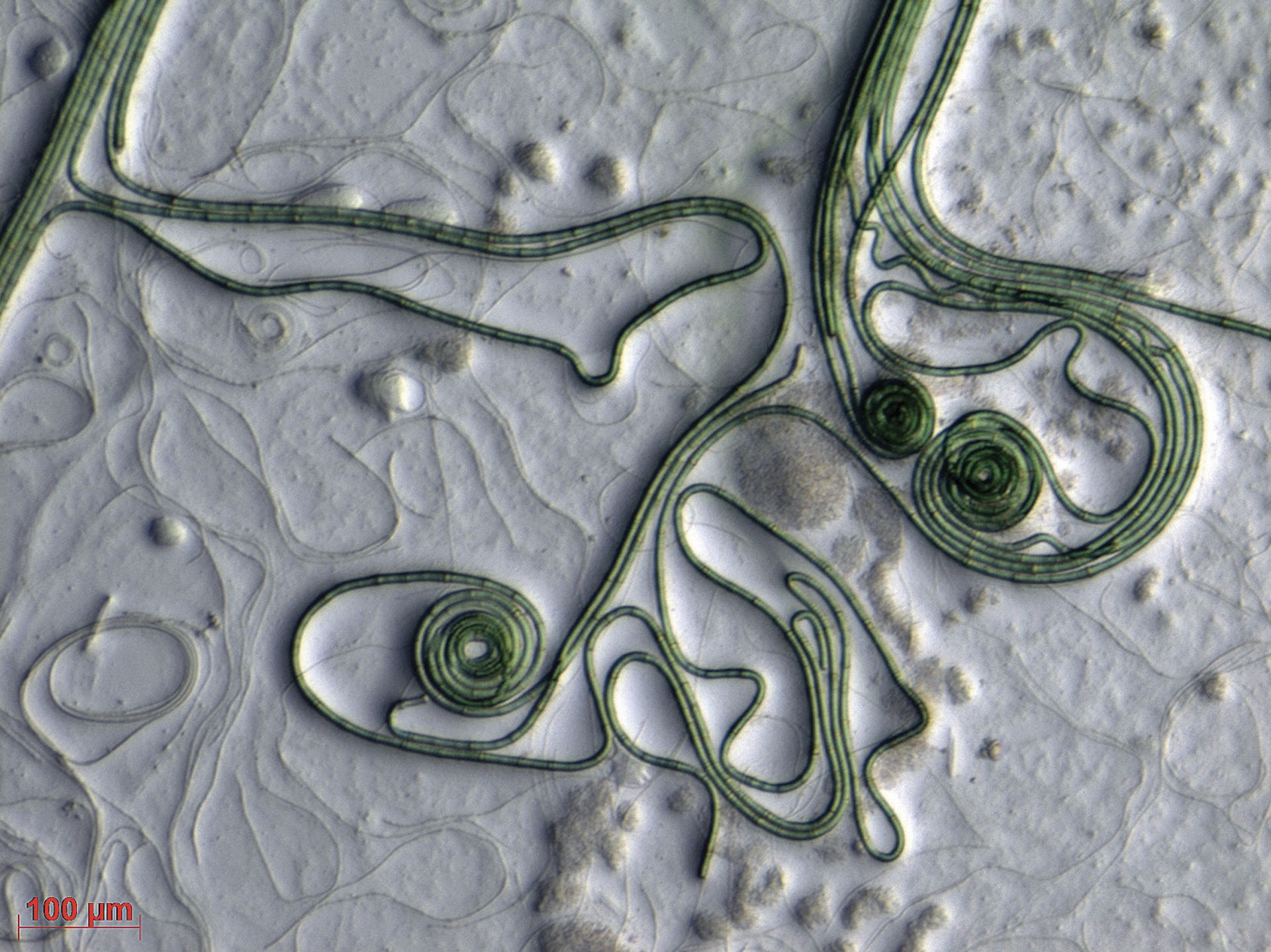 رشته‌های باکتریایی شبیه موی سبز