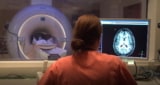 MRI مغز