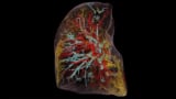 تصویر سه بعدی از ریه انسان